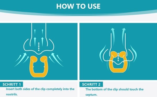 Magnetic Anti Snoring Nose - Image 5