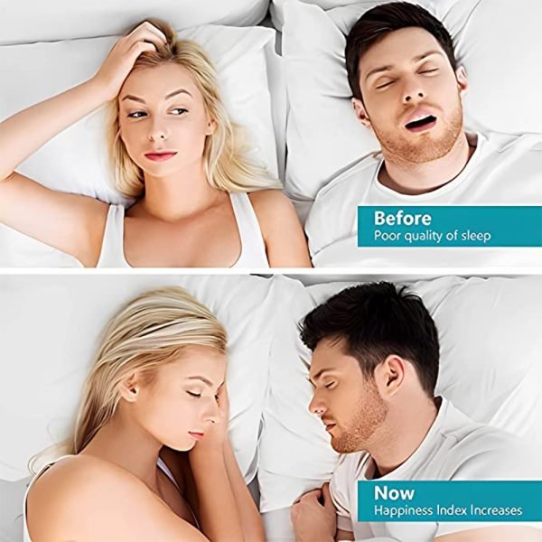 Magnetic Anti Snoring Nose - Image 2